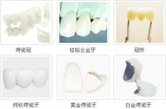 烤瓷牙脱落怎么办？