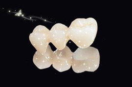 全瓷牙好还是烤瓷牙好？